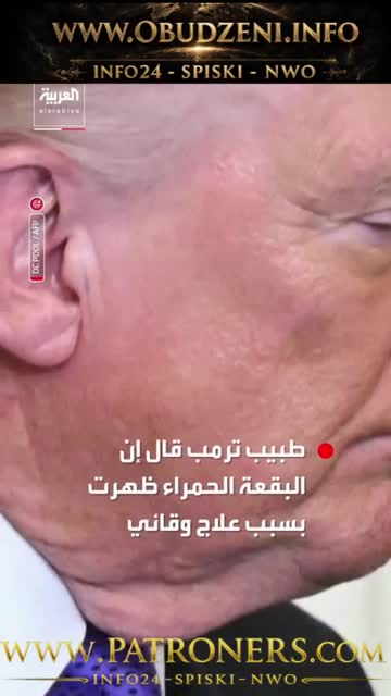 Trump zaczyna gnić_